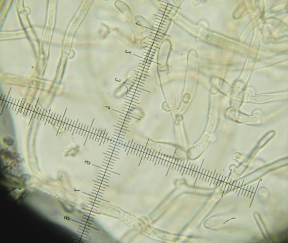 Amphinema byssoides? (Amphinema byssoides)